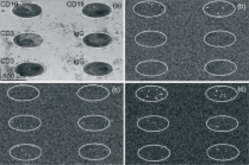 淋巴细胞实时检测