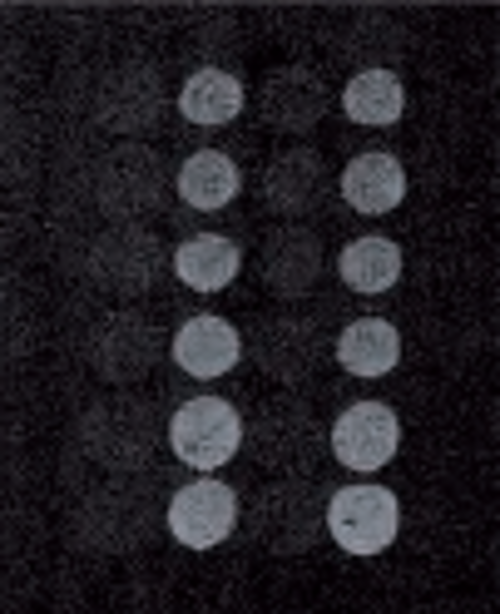 空气中的白桦树花粉过敏原检测