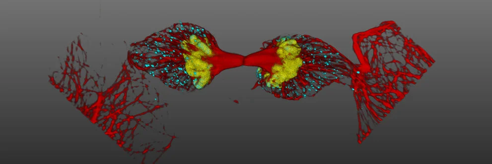 基于人为智能的罕见事务检测利用了自主共聚焦显微镜技术